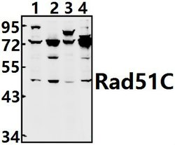 RAD51C Polyclonal Antibody:Antibodies, Polyclonal