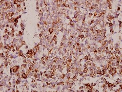 Invitrogen TSPAN8 Polyclonal Antibody 100 &mu;L | Buy Online | Invitrogen&trade; | Fisher Scientific