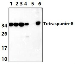 Invitrogen TSPAN8 Polyclonal Antibody 100 &mu;L | Buy Online | Invitrogen&trade; | Fisher Scientific