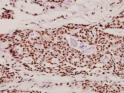 Invitrogen DLX4 Polyclonal Antibody 100 &mu;L | Buy Online | Invitrogen&trade; | Fisher Scientific