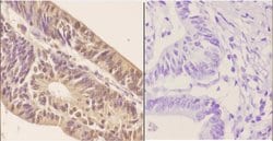 Invitrogen ZNF148 Polyclonal Antibody 100 &mu;L; Unconjugated:Antibodies,