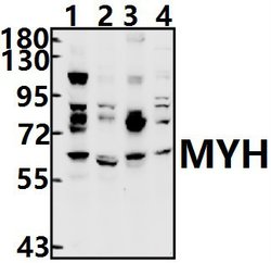 Invitrogen MUTYH Polyclonal Antibody 100 &mu;L; Unconjugated:Antibodies,