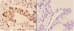 Invitrogen RAD51B Polyclonal Antibody 100 &mu;L; Unconjugated:Antibodies,