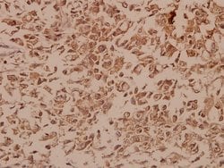 Invitrogen NAB2 Polyclonal Antibody 100 &mu;L; Unconjugated:Antibodies,