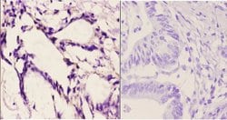Invitrogen FZD10 Polyclonal Antibody 100 &mu;L; Unconjugated:Antibodies,