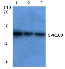 Invitrogen GPR160 Polyclonal Antibody 100 &mu;L; Unconjugated:Antibodies,