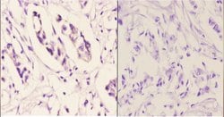 Invitrogen TNFAIP6 Polyclonal Antibody 100 μL; Unconjugated:Antibodies,