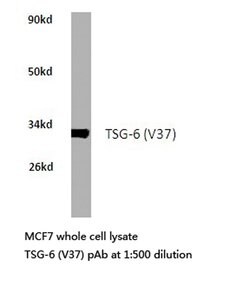 Invitrogen TNFAIP6 Polyclonal Antibody 100 μL; Unconjugated:Antibodies,