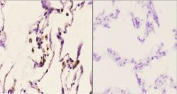 Invitrogen CAF1 p60 Polyclonal Antibody 100 &mu;L | Buy Online | Invitrogen&trade; | Fisher Scientific