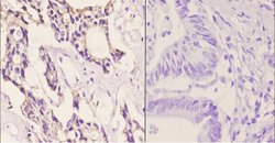 Invitrogen CAF1 p60 Polyclonal Antibody 100 &mu;L | Buy Online | Invitrogen&trade; | Fisher Scientific