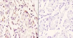 Invitrogen IP6K2 Polyclonal Antibody 100 &mu;L; Unconjugated:Antibodies,