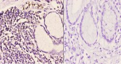 Invitrogen IP6K2 Polyclonal Antibody 100 &mu;L; Unconjugated:Antibodies,