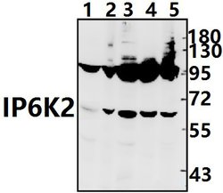 Invitrogen IP6K2 Polyclonal Antibody 100 &mu;L; Unconjugated:Antibodies,
