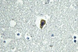 BAI1 Polyclonal Antibody:Antibodies, Polyclonal