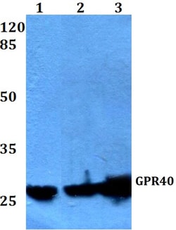 Invitrogen GPR40 Polyclonal Antibody 100 &mu;L; Unconjugated:Antibodies,