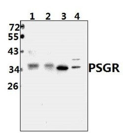 Invitrogen PSGR Polyclonal Antibody 100 &mu;L; Unconjugated:Antibodies,