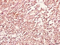 Invitrogen GABRB2 Polyclonal Antibody 100 &mu;L; Unconjugated:Antibodies,