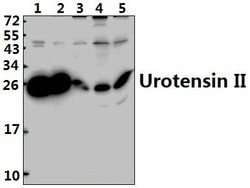 Invitrogen UTS2 Polyclonal Antibody 100 &mu;L; Unconjugated:Antibodies,