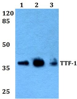 Invitrogen Nkx2.1 Polyclonal Antibody 100 &mu;L; Unconjugated:Antibodies,