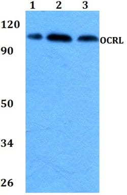 Invitrogen OCRL Polyclonal Antibody 100 &mu;L; Unconjugated:Antibodies,