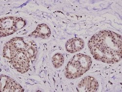Invitrogen KIF20A Polyclonal Antibody 100 &mu;L; Unconjugated:Antibodies,