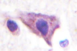 Kir5.1 (KCNJ16) Polyclonal Antibody:Antibodies, Polyclonal