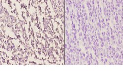 Invitrogen HCCS Polyclonal Antibody 100 &mu;L; Unconjugated:Antibodies,