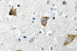 Invitrogen RPS20 Polyclonal Antibody 100 &mu;L; Unconjugated:Antibodies,