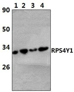 Invitrogen RPS4Y1 Polyclonal Antibody 100 &mu;L | Buy Online | Invitrogen&trade; | Fisher Scientific