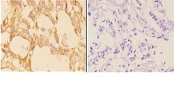 Invitrogen ABCB10 Polyclonal Antibody 100 &mu;L; Unconjugated:Antibodies,