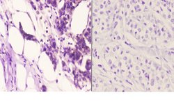 OXER1 Polyclonal Antibody:Antibodies, Polyclonal
