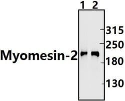 Invitrogen MYOM2 Polyclonal Antibody 100 &mu;L; Unconjugated:Antibodies,