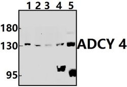 Invitrogen Adenylate Cyclase 4 Polyclonal Antibody 100 &mu;L; Unconjugated:Antibodies,
