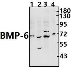 Invitrogen BMP-6 Polyclonal Antibody 100 &mu;L | Buy Online | Invitrogen&trade; | Fisher Scientific
