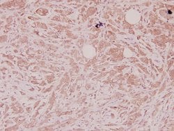 Invitrogen DEFA1 Polyclonal Antibody 100 &mu;L; Unconjugated:Antikroppar