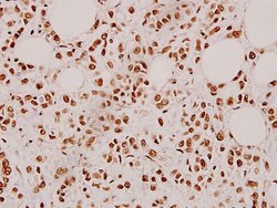 Invitrogen Cardiotrophin 1 Polyclonal Antibody 100 &mu;L; Unconjugated:Antibodies,