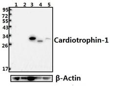Invitrogen Cardiotrophin 1 Polyclonal Antibody 100 &mu;L; Unconjugated:Antibodies,