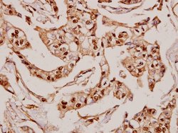 MRPS36 Polyclonal Antibody:Antibodies, Polyclonal