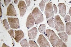 Invitrogen Neuromedin U-8 Polyclonal Antibody 100 &mu;L; Unconjugated:Antibodies,