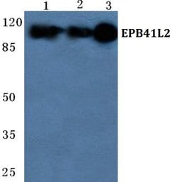 Invitrogen EPB41L2 Polyclonal Antibody 100 &mu;L; Unconjugated:Antibodies,