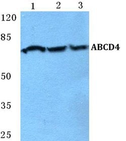 Invitrogen ABCD4 Polyclonal Antibody 100 &mu;L; Unconjugated:Antibodies,