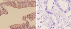 Invitrogen Arp3 Polyclonal Antibody 100 &mu;L; Unconjugated:Antibodies,