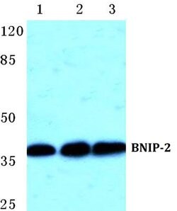 Invitrogen BNIP2 Polyclonal Antibody 100 &mu;L | Buy Online | Invitrogen&trade; | Fisher Scientific