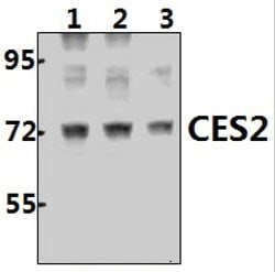 Invitrogen CES2 Polyclonal Antibody 100 &mu;L; Unconjugated:Antibodies,