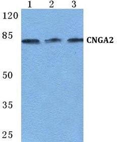 Invitrogen CNGA2 Polyclonal Antibody 100 &mu;L | Buy Online | Invitrogen&trade; | Fisher Scientific