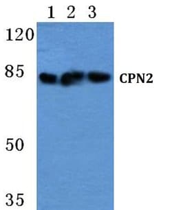 Invitrogen CPN2 Polyclonal Antibody 100 &mu;L; Unconjugated:Antibodies,