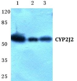 Invitrogen CYP2J2 Polyclonal Antibody 100 &mu;L; Unconjugated:Antibodies,