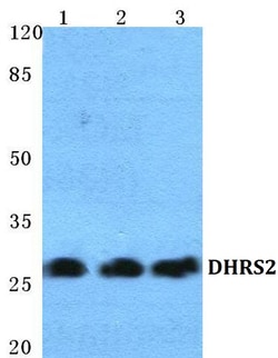 Invitrogen DHRS2 Polyclonal Antibody 100 &mu;L; Unconjugated:Antibodies,