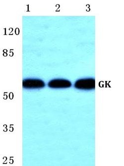 Invitrogen Glycerol kinase Polyclonal Antibody 100 &mu;L; Unconjugated:Antibodies,