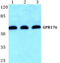 Invitrogen GPR176 Polyclonal Antibody 100 &mu;L | Buy Online | Invitrogen&trade; | Fisher Scientific
